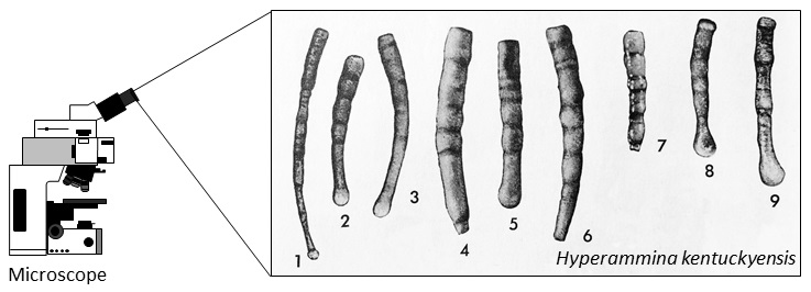 Agglutinated foraminifera